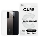 Puzdro X-Ray pre Xiaomi 15T Pro 5G, Transparentná, CARE